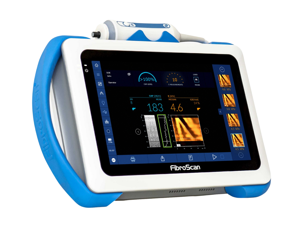 imagen-fibroscan-tuhigadovital