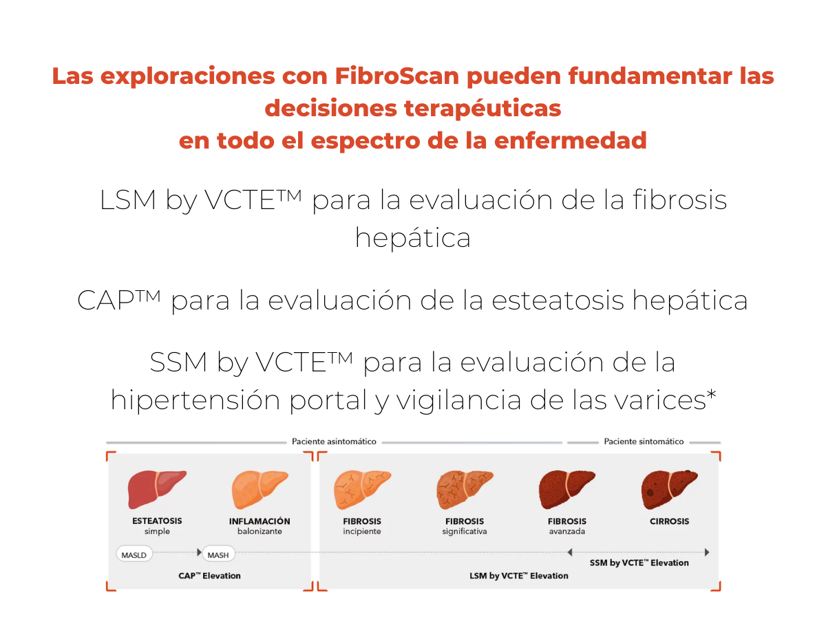 info-fibroscan-22